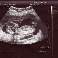 abortion in israel